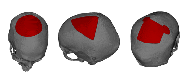  Segmentation Example