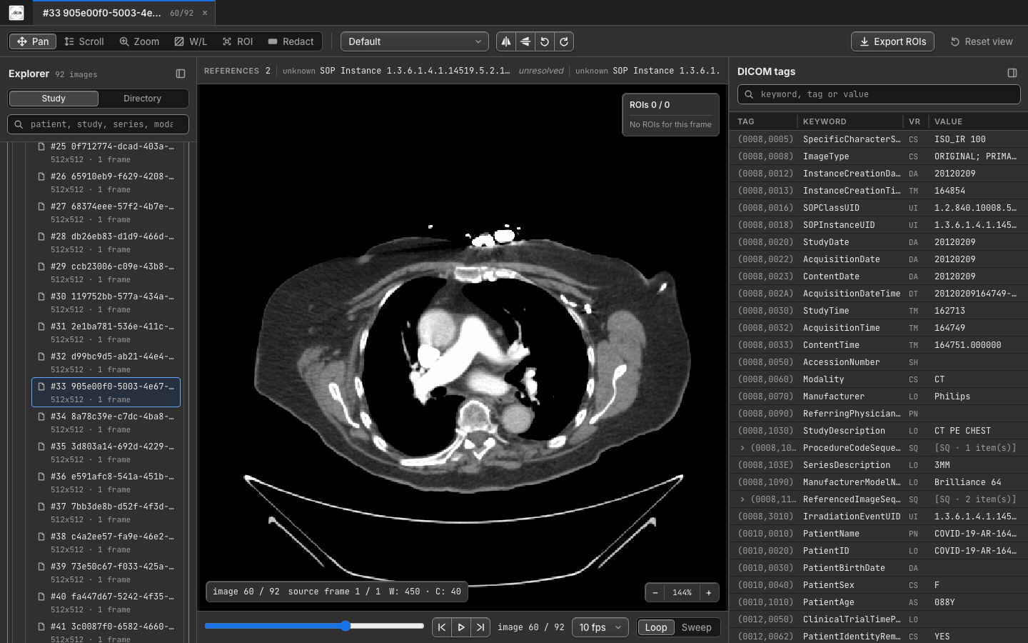 DICOM cine playback in dcmview