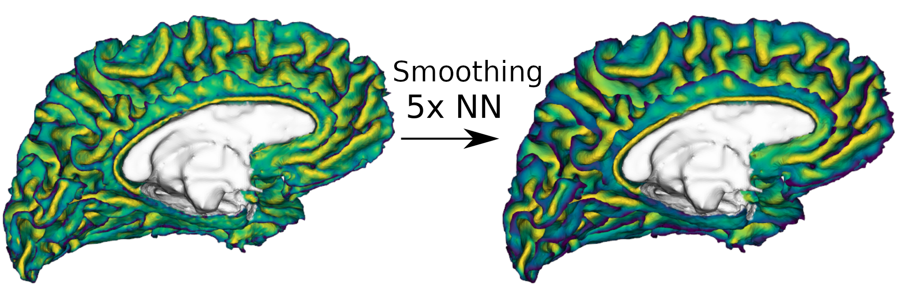 Figure 1, Showing a brain mesh with an overlay, before and after smoothing.