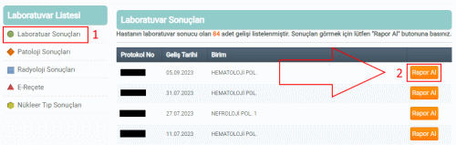 Laboratuvar Sonuçları
