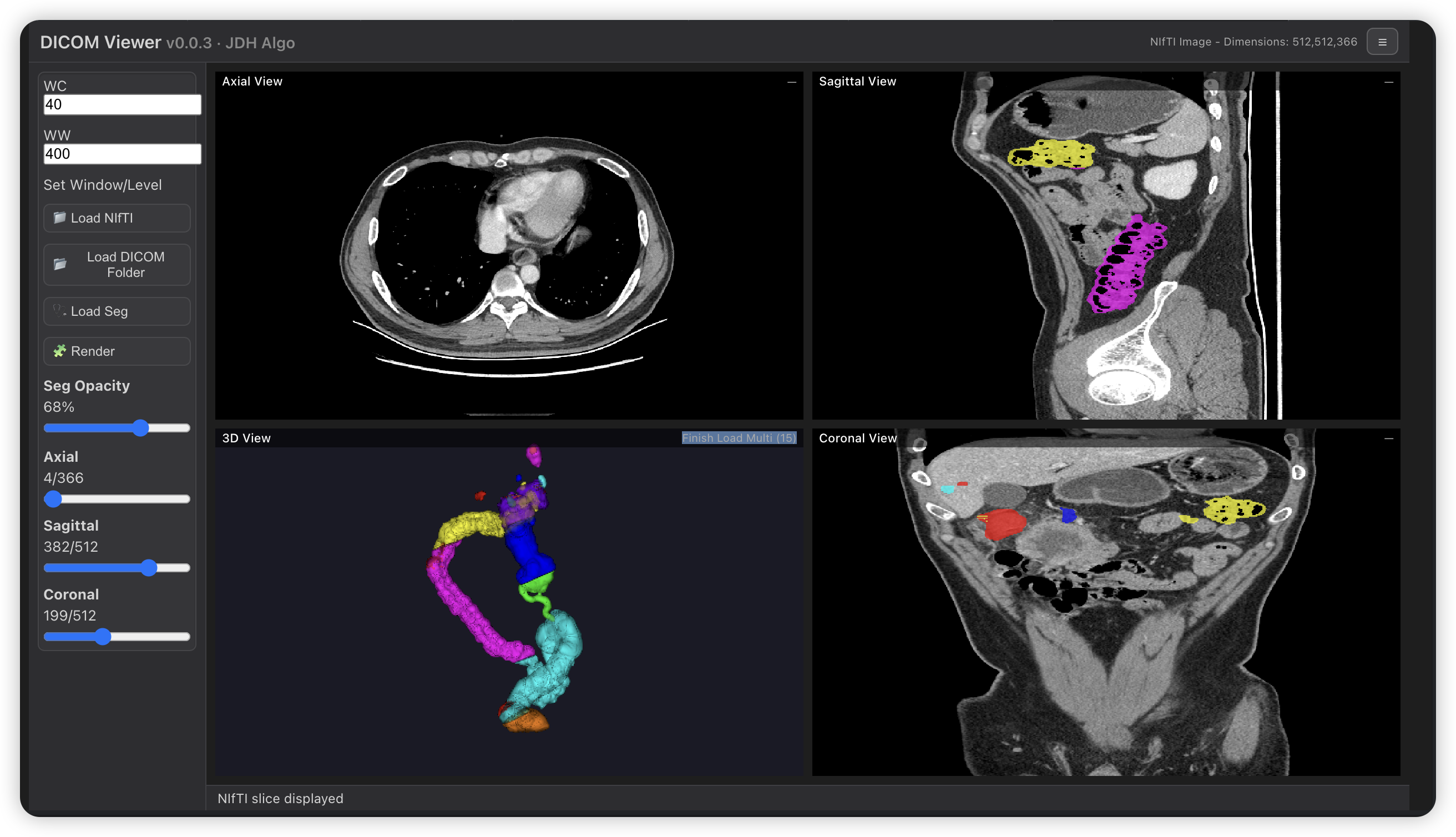 DICOM Viewer Demo