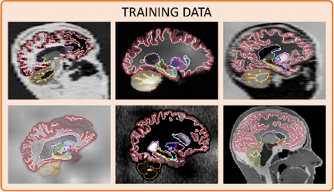 Training data