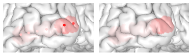 Electrode values (p-value) mapped on to the pial surface. Left: electrodes are visible; Right: electrodes are hidden.
