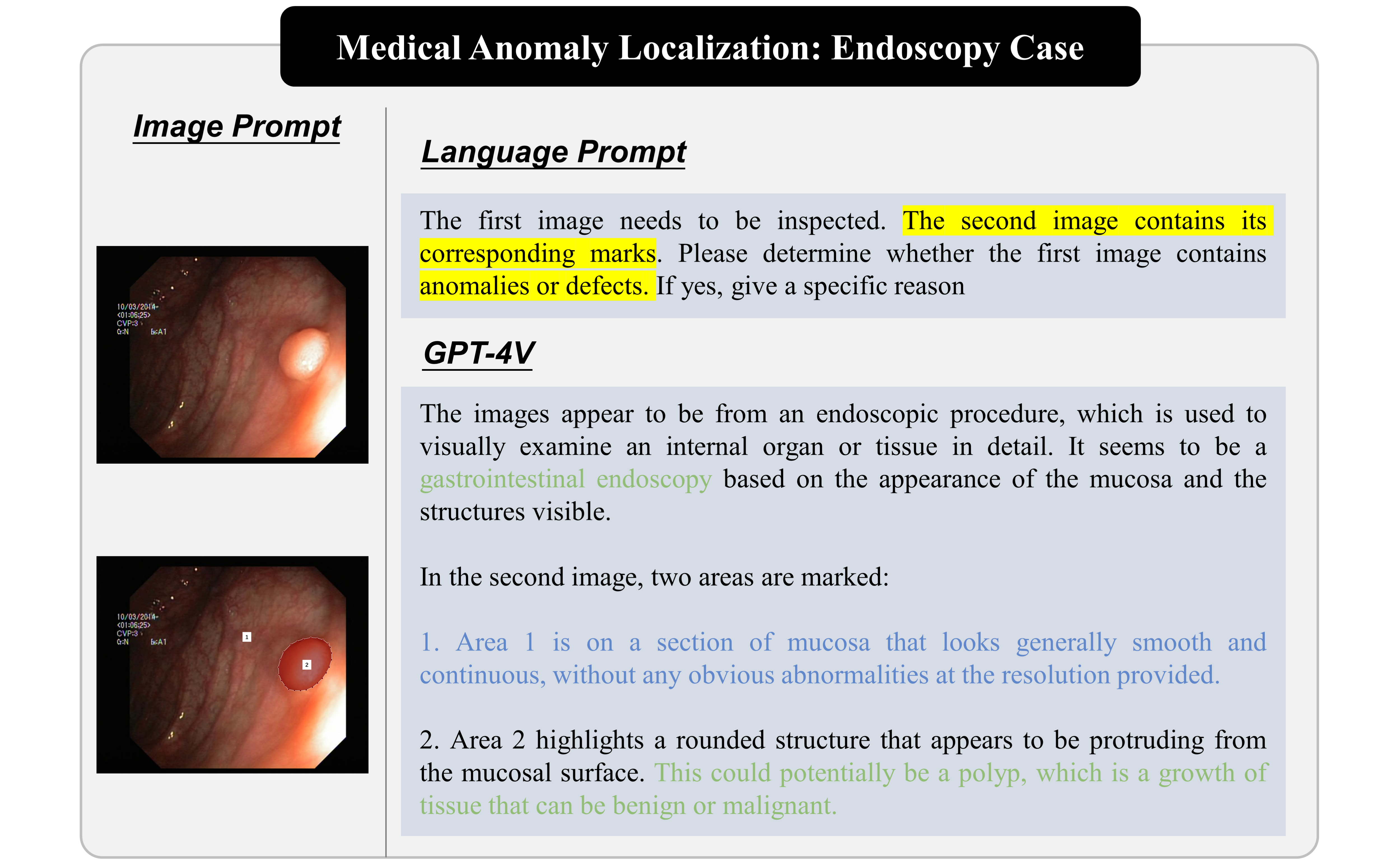 Medical Image Anomaly Localization