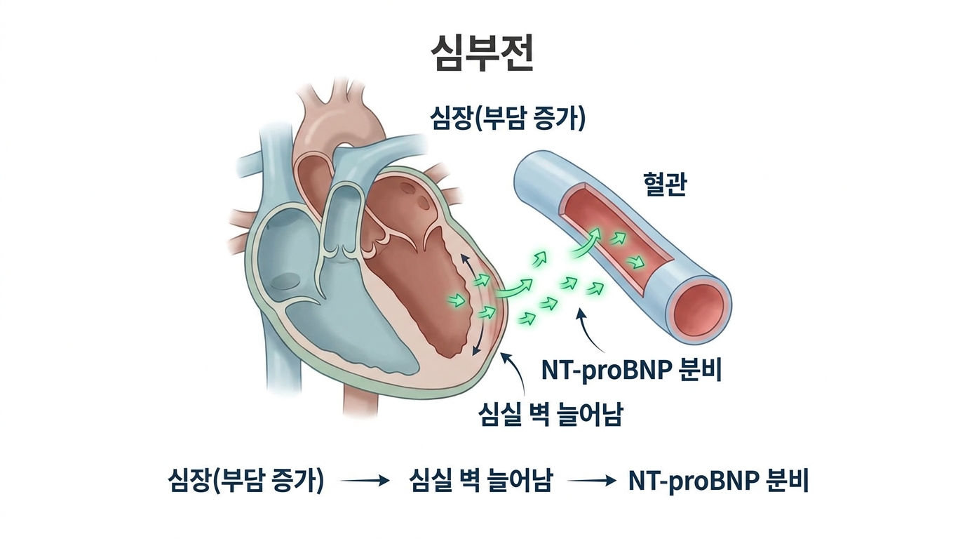 NT-proBNP (심부전 표지자)