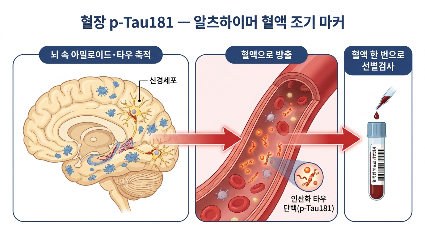 p-Tau181 (알츠하이머 혈액마커)