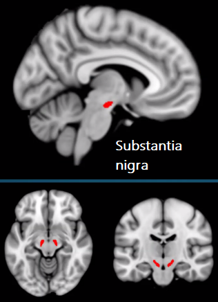 Figure from 2022_Transcript, page image10