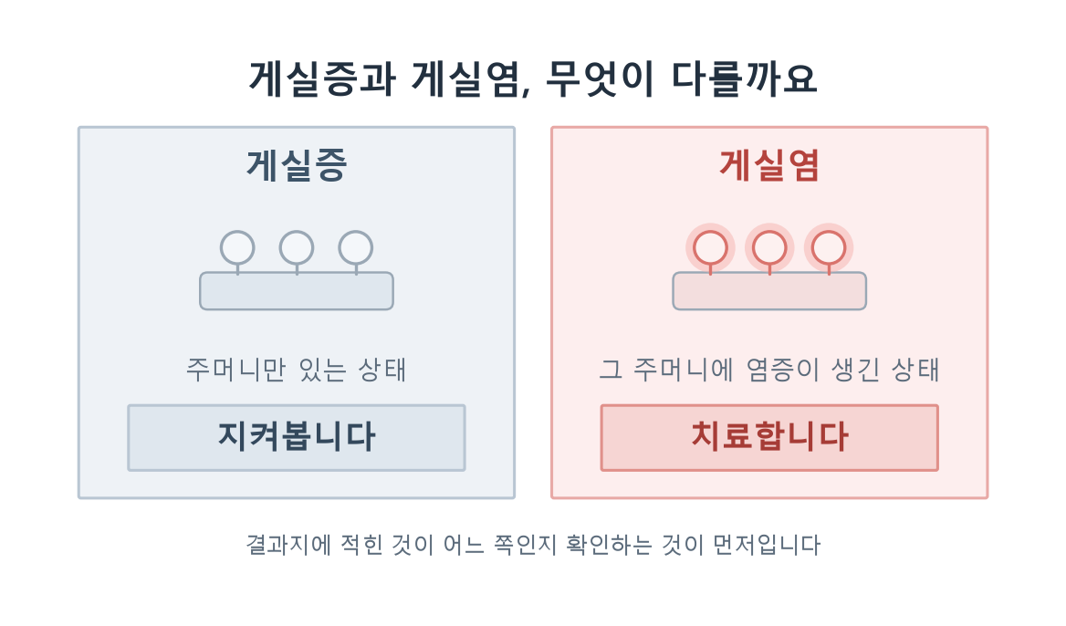 게실증과 게실염 비교표. 게실증은 주머니만 있는 상태로 지켜보고, 게실염은 주머니에 염증이 생긴 상태로 치료합니다.