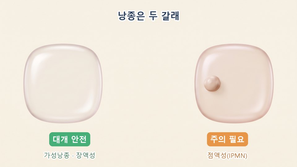 췌장 낭종 종류 - 안전한 낭종과 주의할 낭종