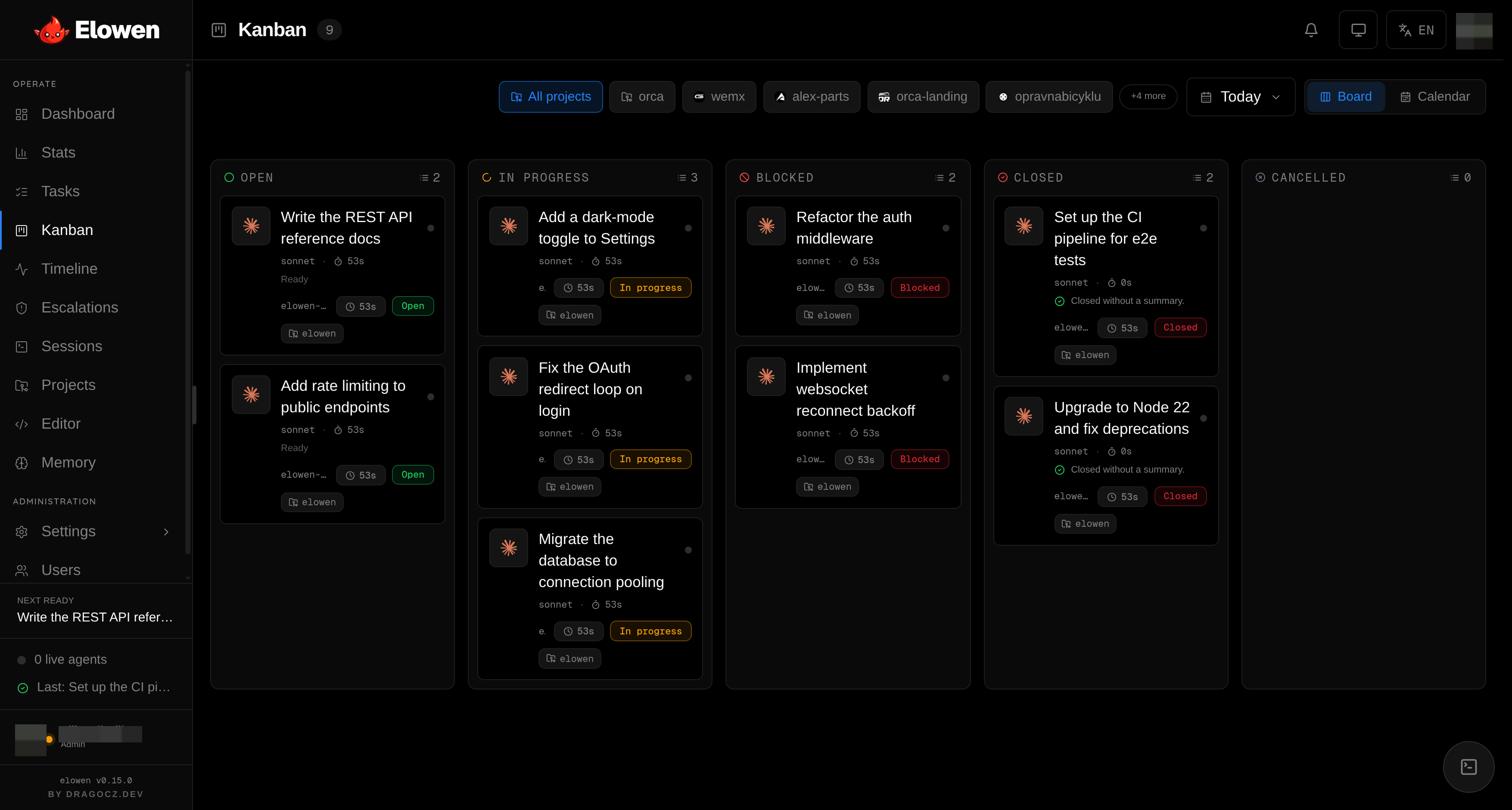 The Kanban board with drag-and-drop columns and expandable epics
