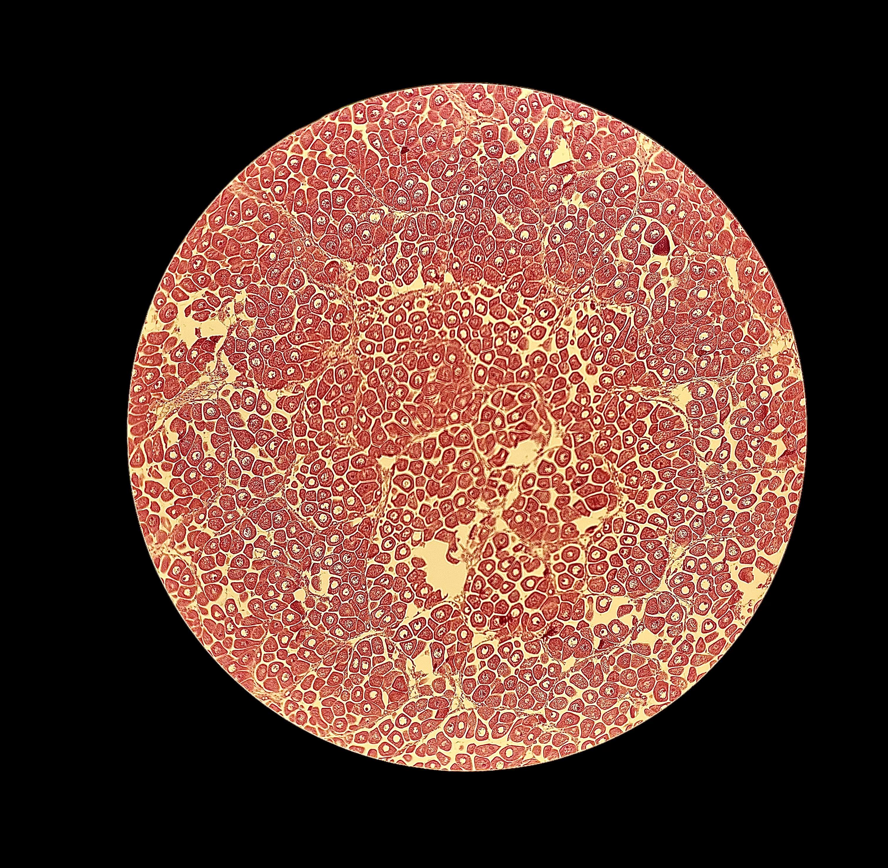 Diploid - mature female (stage 3)