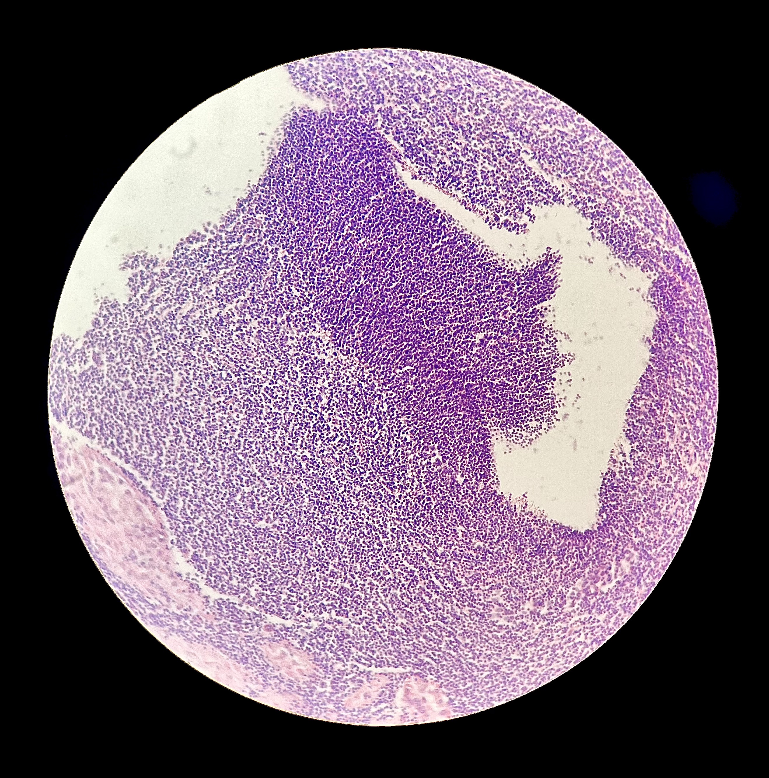 Diploid - mature male (stage 4)