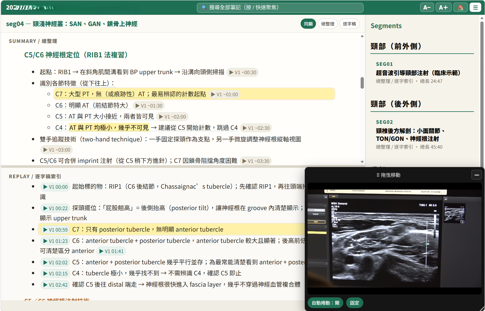 Synced view — summary and transcript index with a draggable floating player; the highlighted bullet follows the video