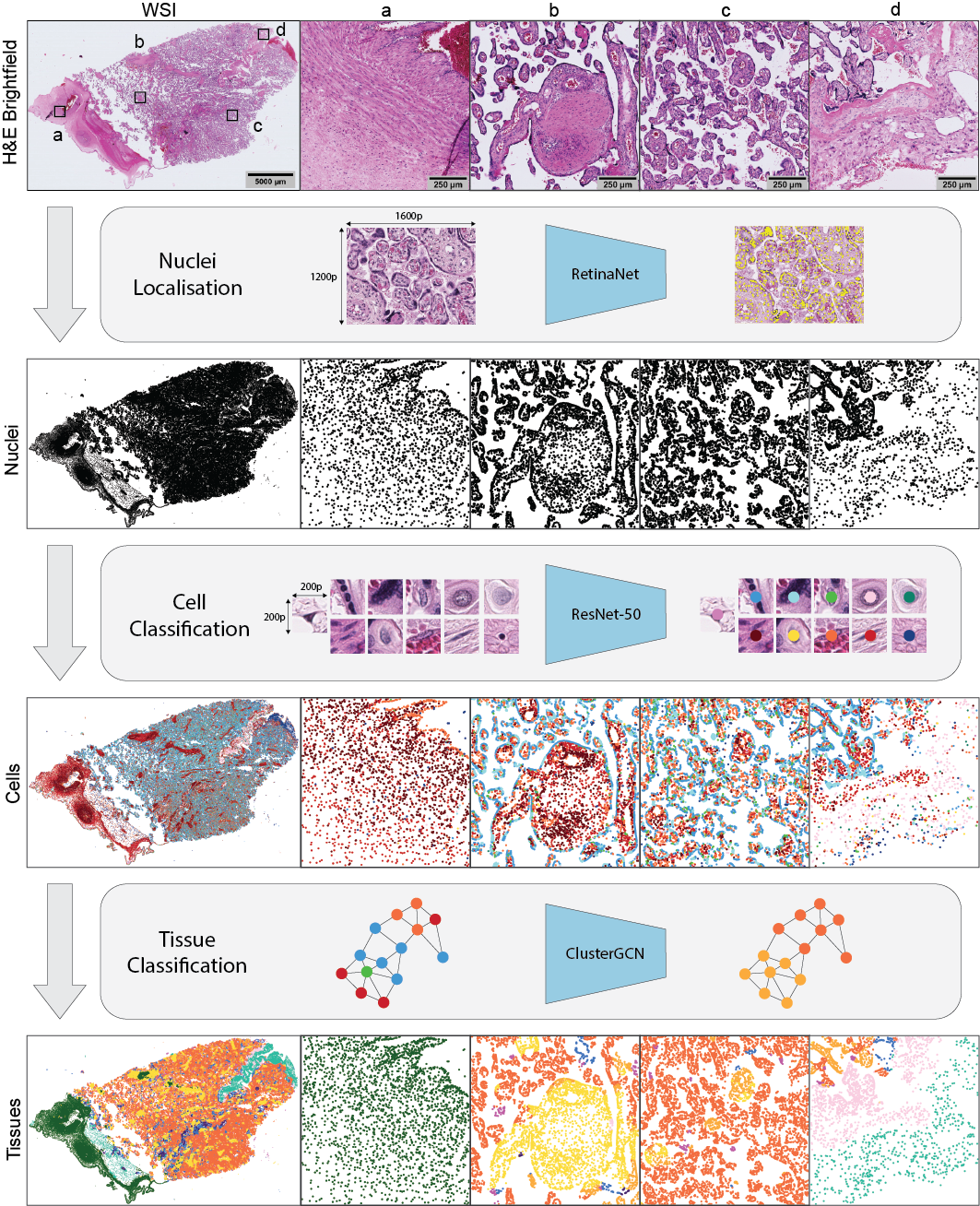 Published HAPPY pipeline figure showing hierarchical analysis of placental whole slide histology
