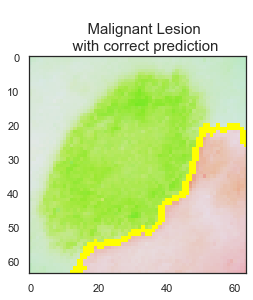 malignantcorrect