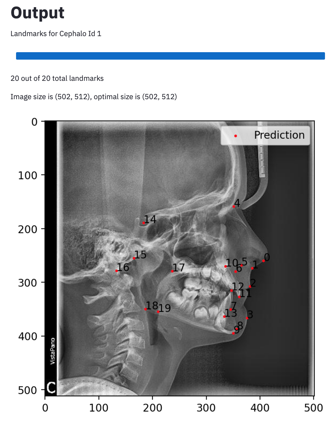 Screenshot from application with example xray and predictions