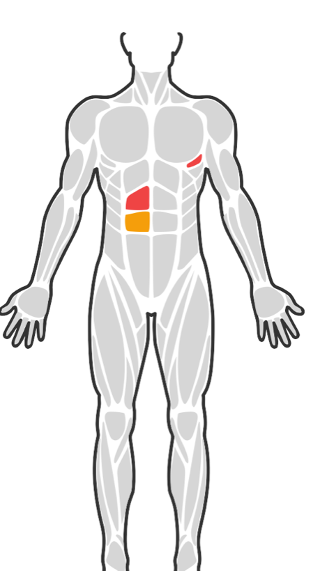 Read-only body diagram with fragments coloured by severity