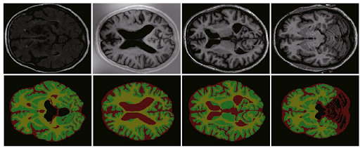 Medical image segmentation example