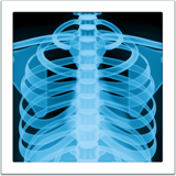 apple version: Lung