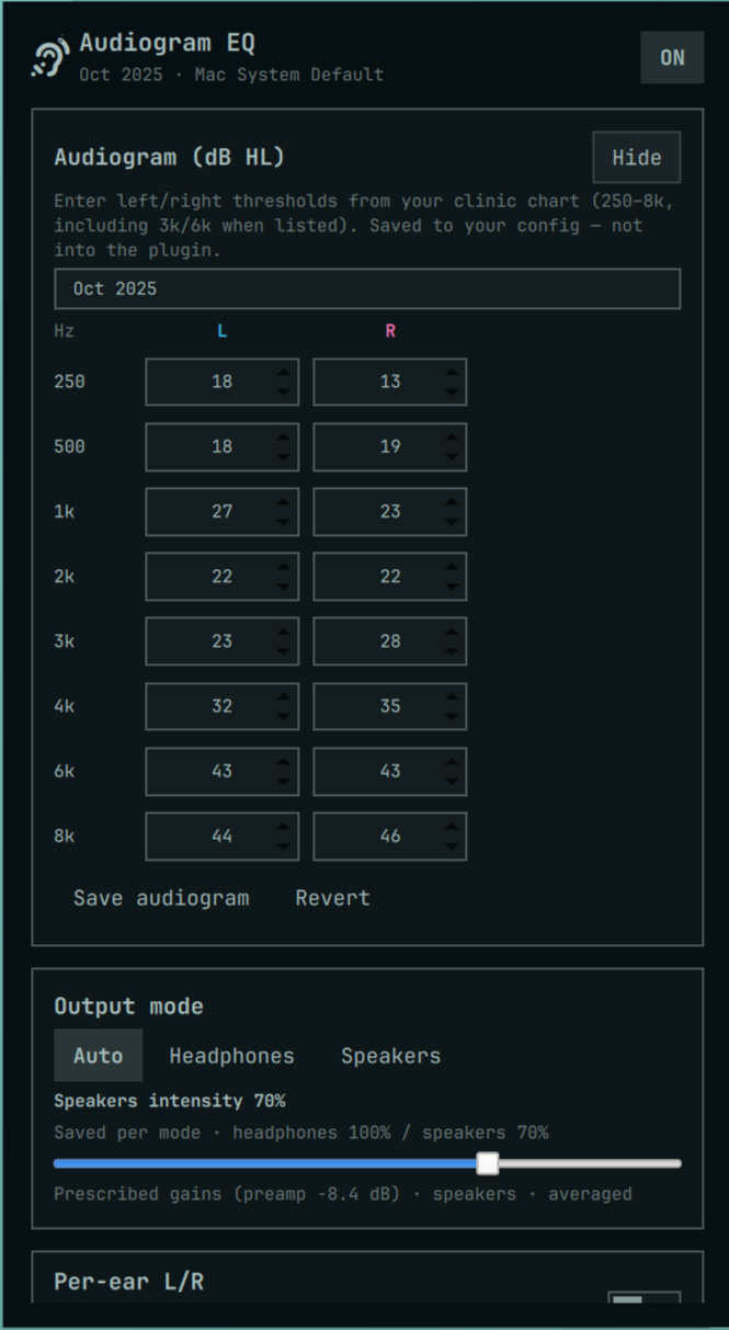 Audiogram editor (dB HL thresholds)