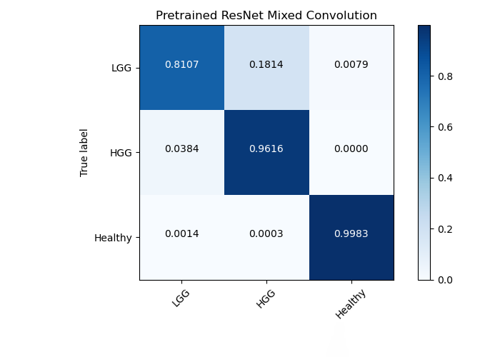 confusion matrix pretrained resnet 
                                                    conv