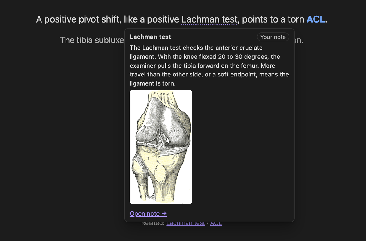 Hovering a term shows your own note about it