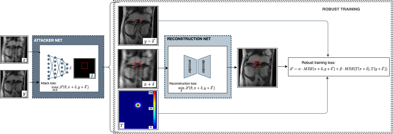 Adversarial Robust Training of Deep Learning MRI Reconstruction Models ...