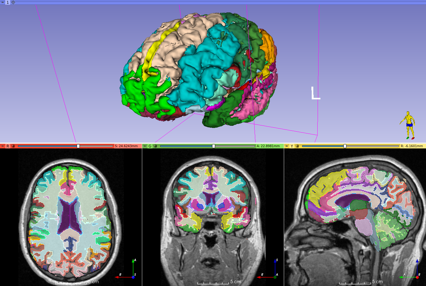 Brain Parcellation module