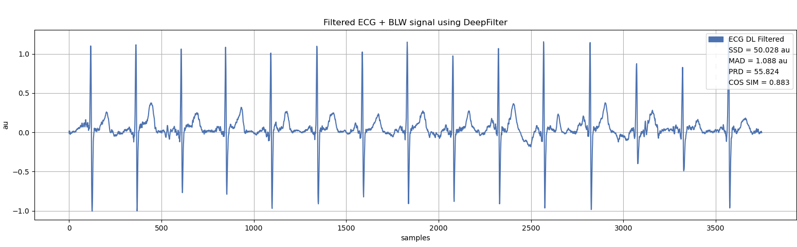 ECG filtered using DeepFilter