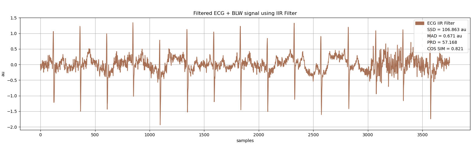 ECG filtered using IIR classical filter