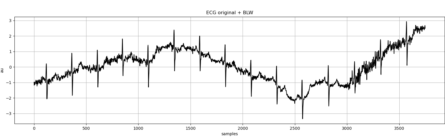 Original ECG signal + BLW noise
