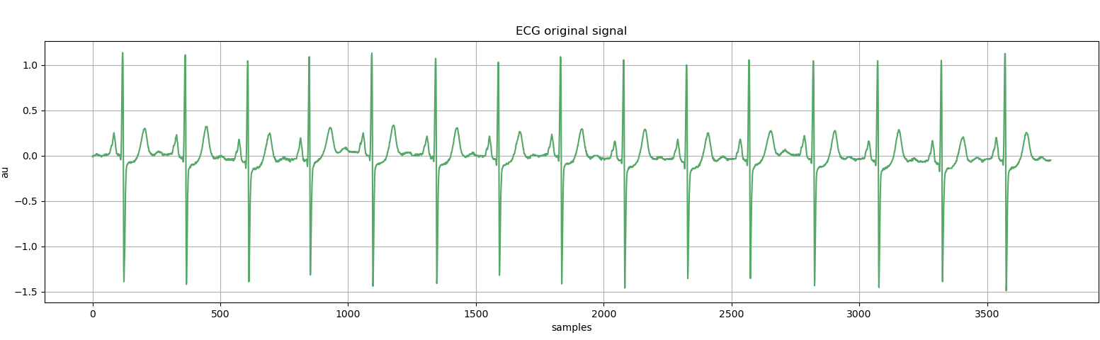 Original ECG signal