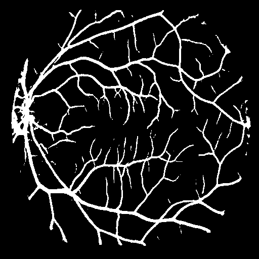 Predicted blood vessels