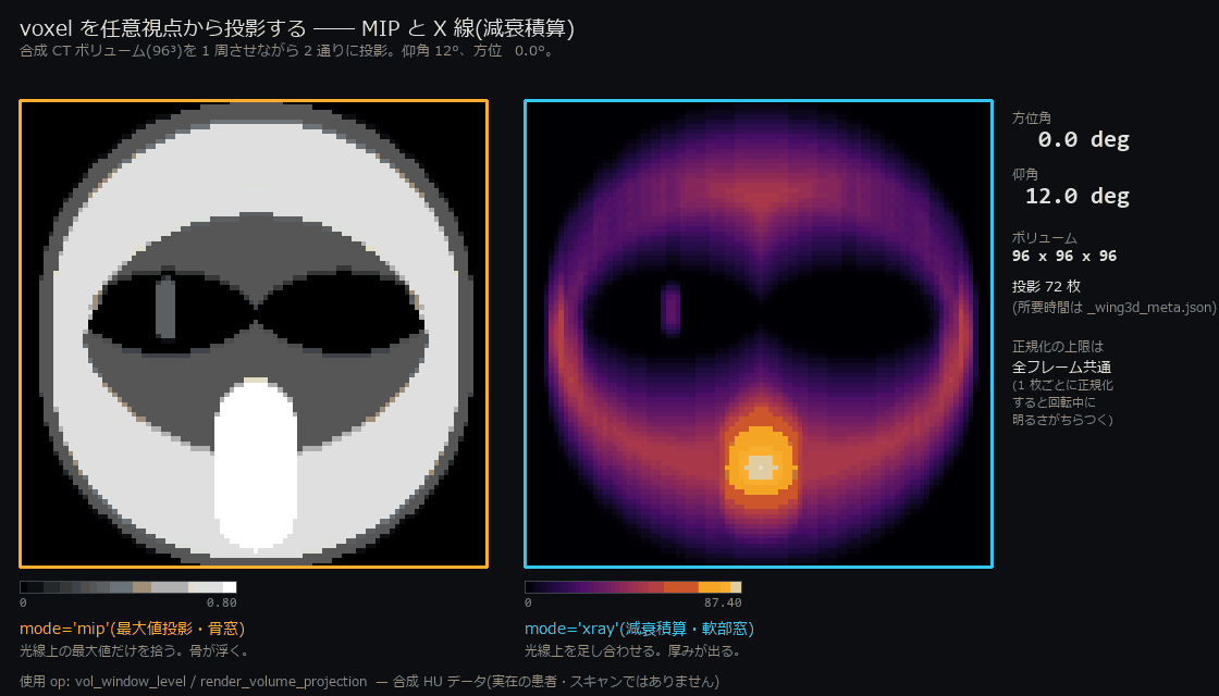 MIP と X 線投影のターンテーブル