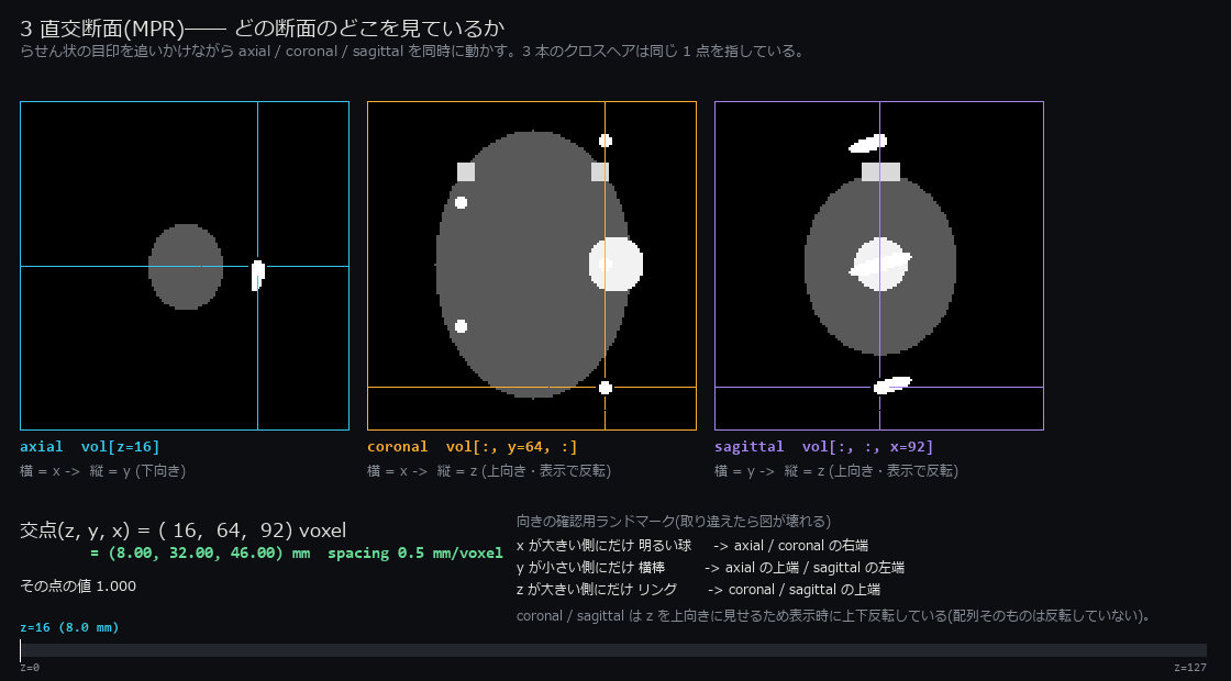 3 直交断面(MPR)とクロスヘア