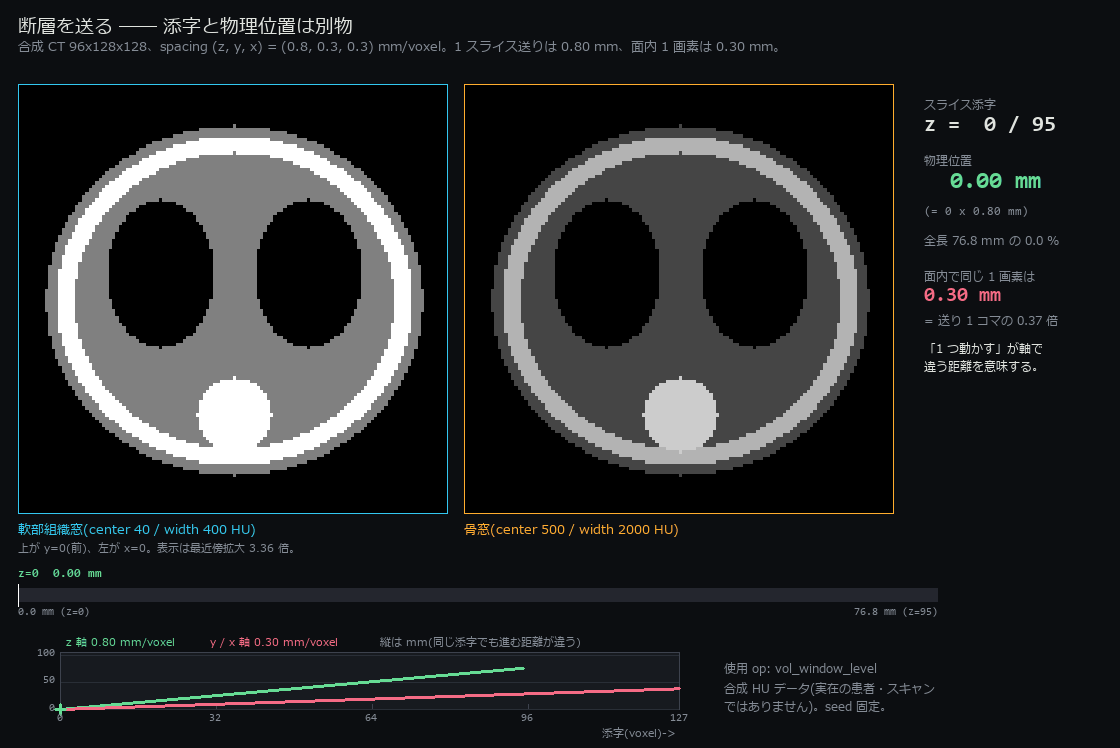 断層を送る ―― `z = 48 / 95` は 38.40 mm のこと