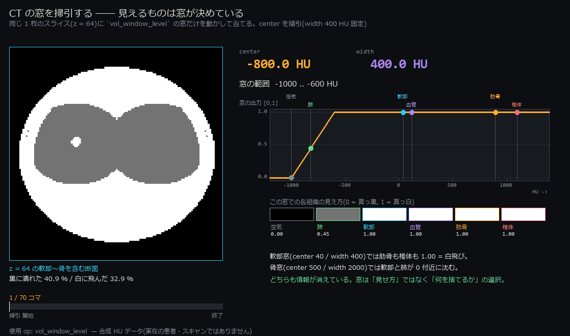 CT の窓を掃引する ―― 見えるものは窓が決めている