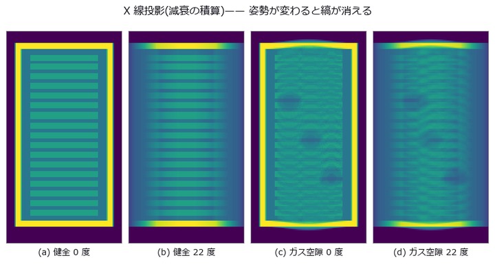 真正面(0 度)なら空隙の影までは見える。ただし奥行きに積算されているので厚みも深さも出ない。22 度傾けると層の縞そのものが重なって消える —— 投影では姿勢が結果を決めてしまう。だから断層に落とす。