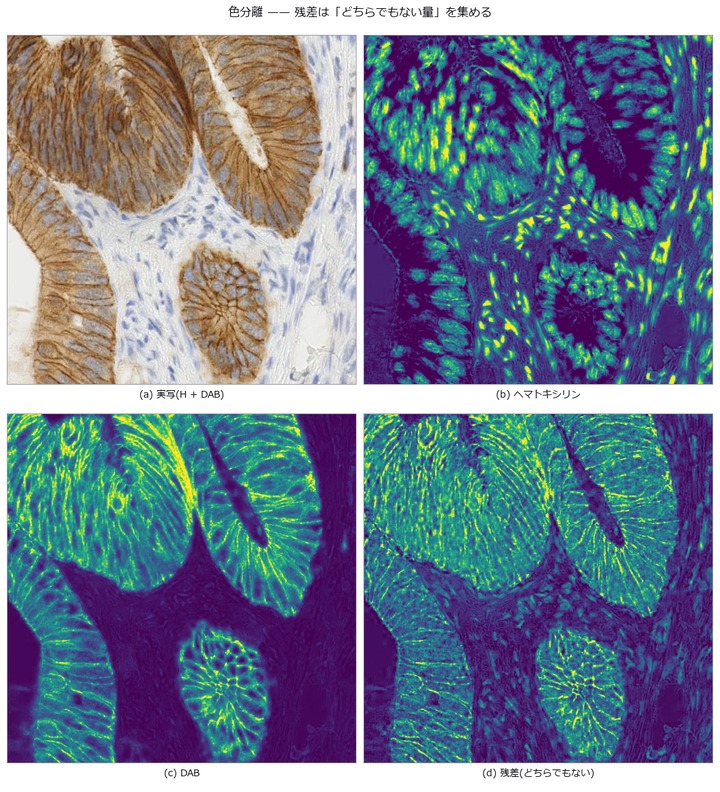Separating a Real Immunostain by Colour — The Watchdog Was Blind to Exactly the Error It Should Catch