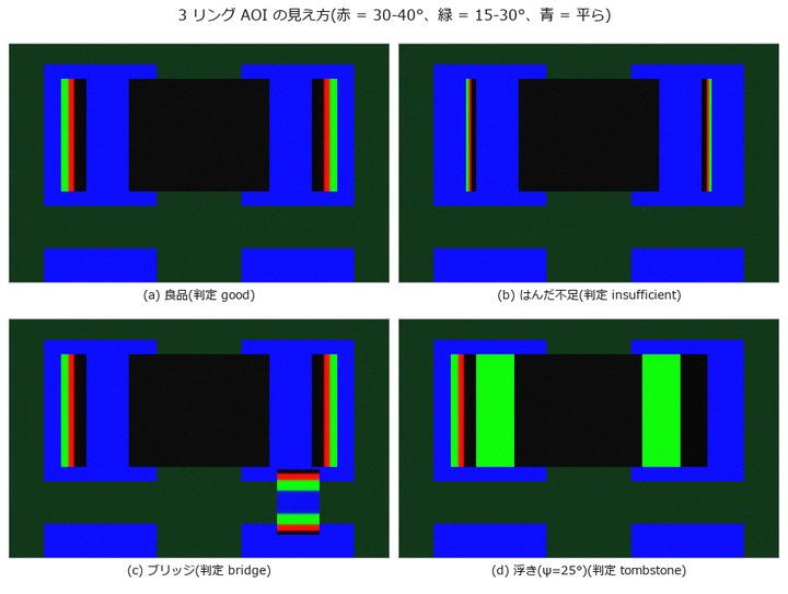 Solder fillet AOI — three ring lights are a 3-level tilt quantiser, and 70 % of the fillet height sits in the dark