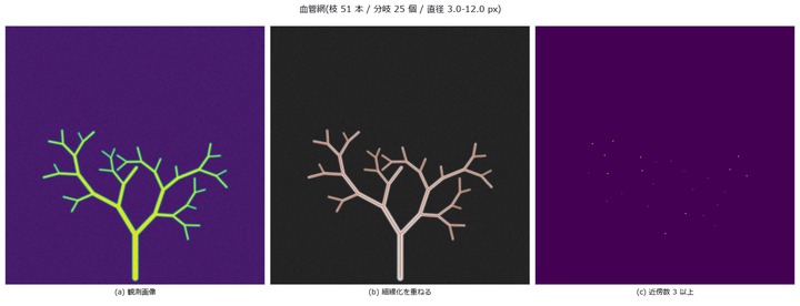 Extracting a Vessel Network — Spurs, Overestimated Radii Near Branches, and a Fragile Exponent