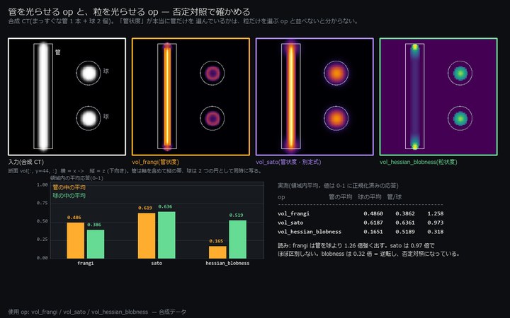 Frangi 対 Sato ―― 否定対照(粒状度)を並べて初めて分かる