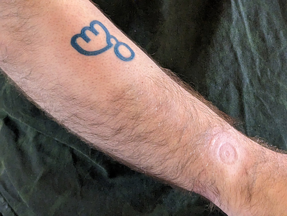 A picture of George's arm, showing a shaved part for his new tattoo but also a shaved wrist.