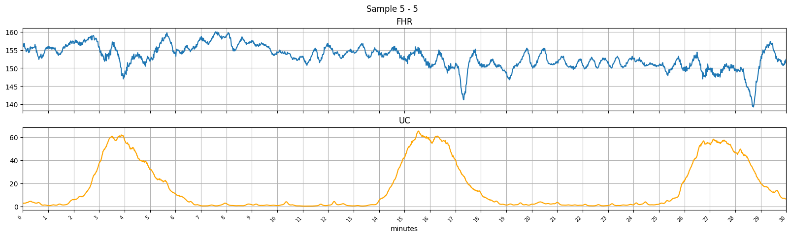 Sample generated with super-resolution