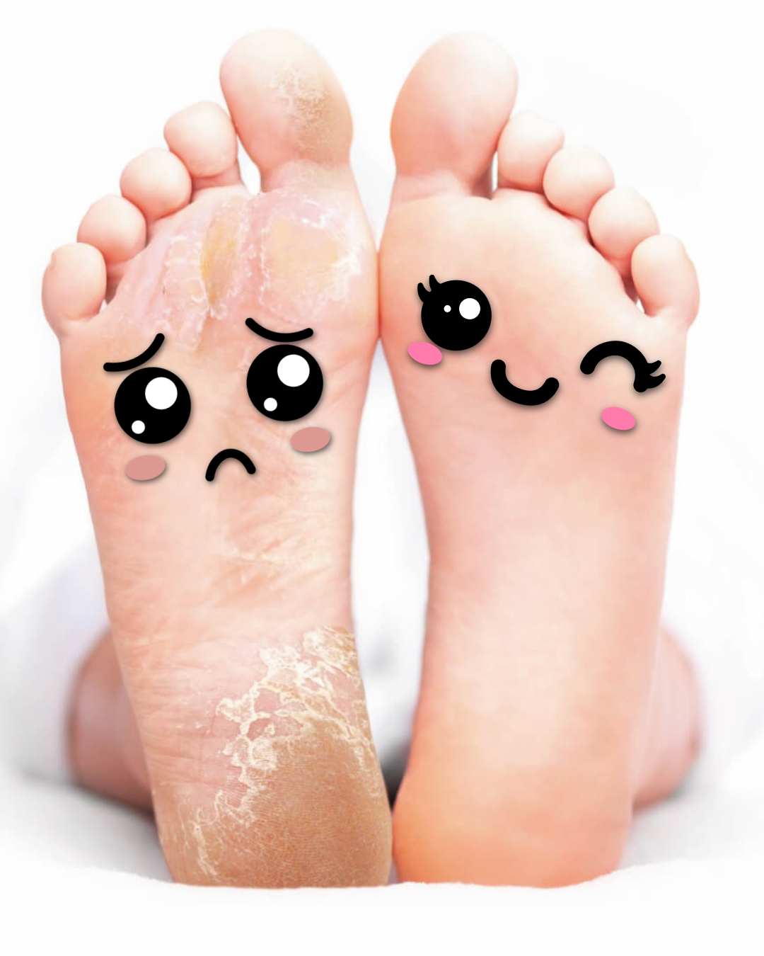 Pedicure