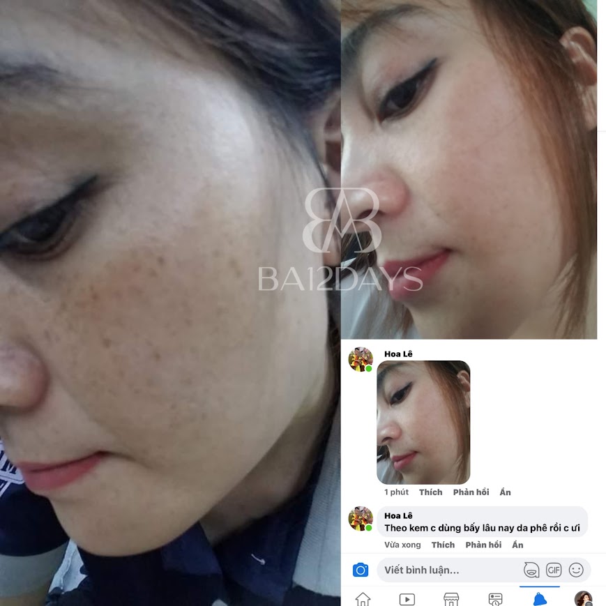 Hình ảnh trước và sau của khách Hoa Lê