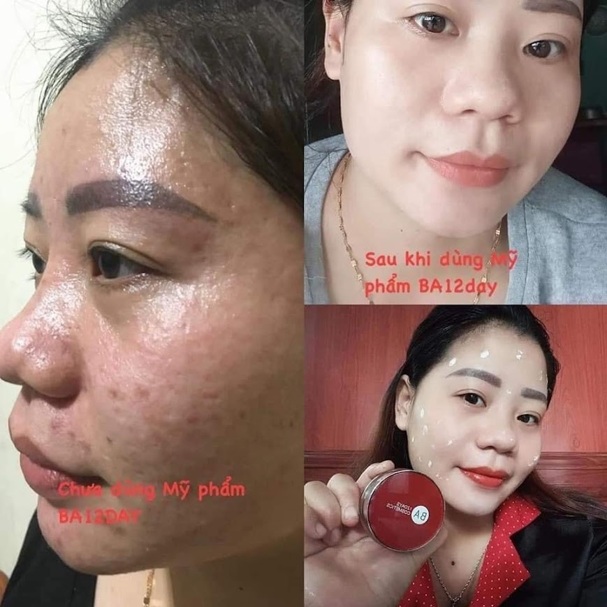 Hình ảnh trước và sau của khách Hồng Nhung