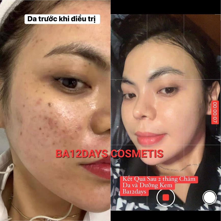 Hình ảnh trước và sau của khách Mỹ Duyên