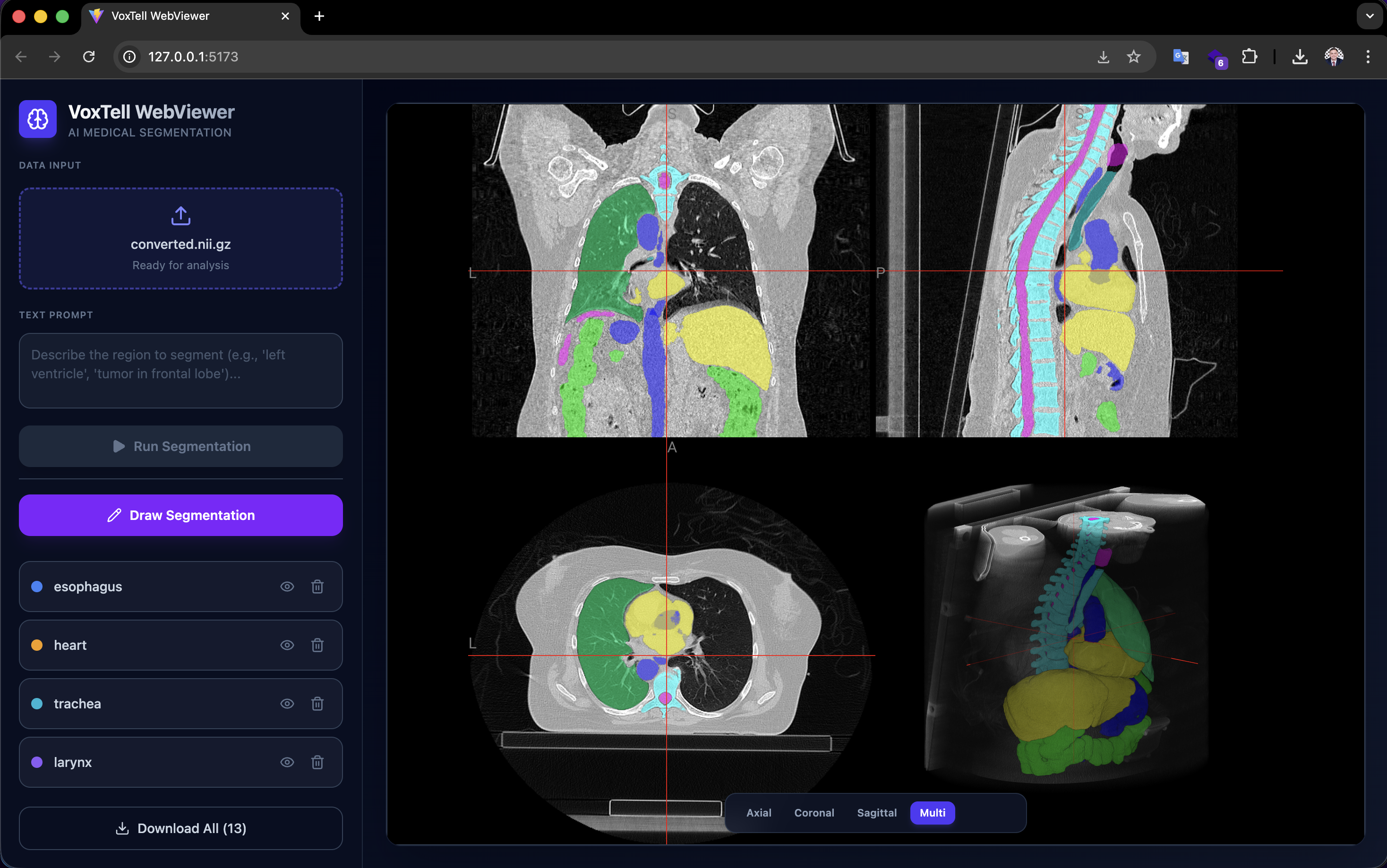 VoxTell Web Interface Demo