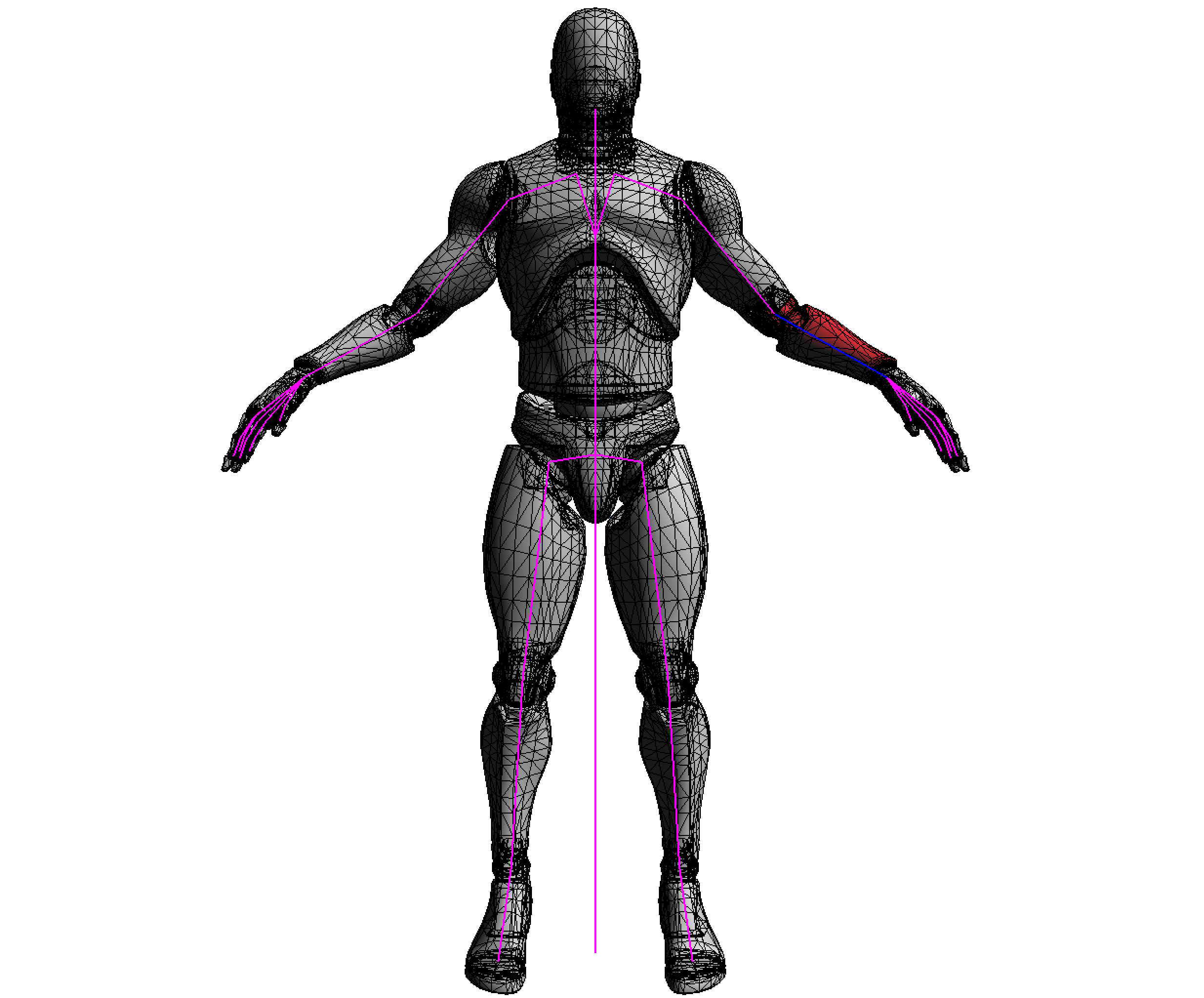 Vertices attached to forearm